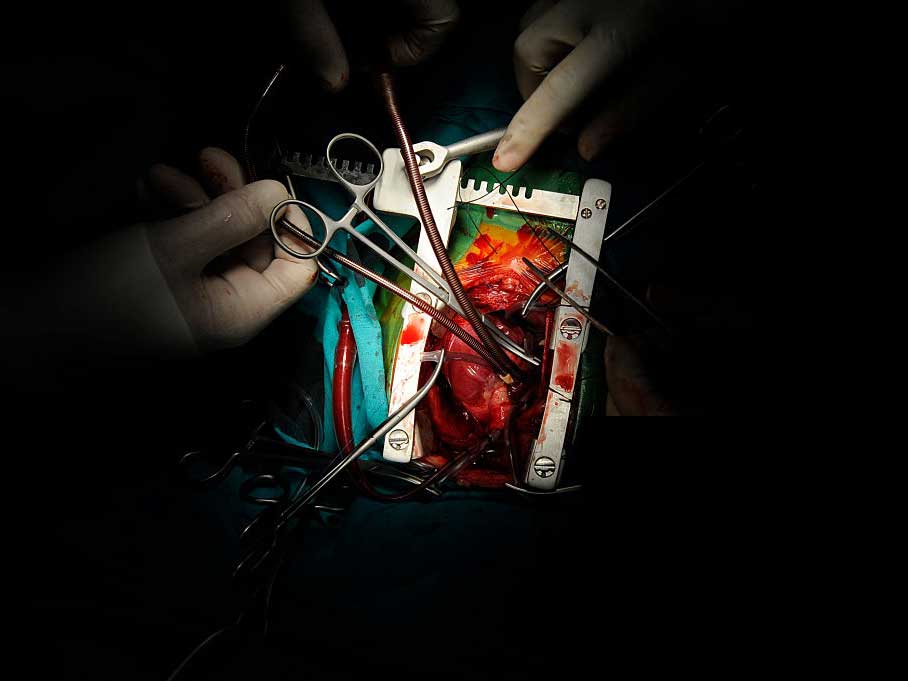 جراحی قلب کودکان